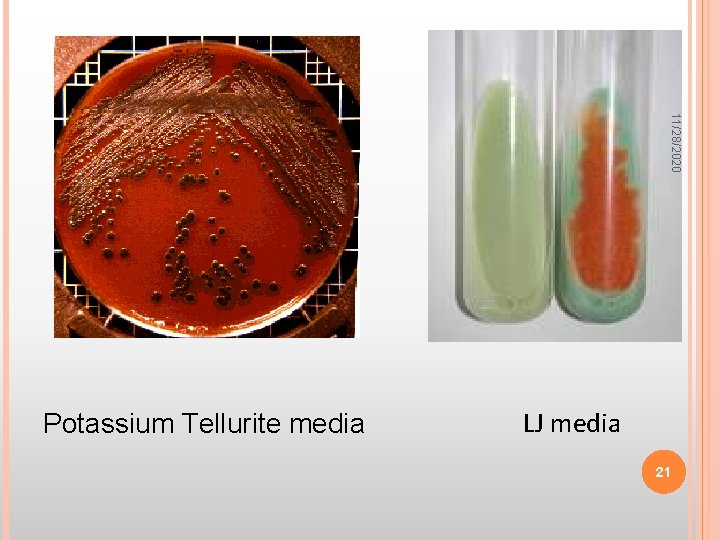 11/28/2020 Potassium Tellurite media LJ media 21 