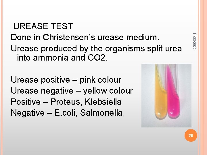 11/28/2020 UREASE TEST Done in Christensen’s urease medium. Urease produced by the organisms split