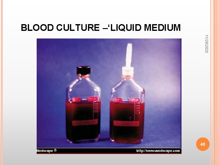 BLOOD CULTURE –‘LIQUID MEDIUM 11/28/2020 40 