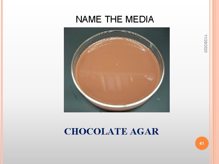 NAME THE MEDIA 11/28/2020 CHOCOLATE AGAR 41 