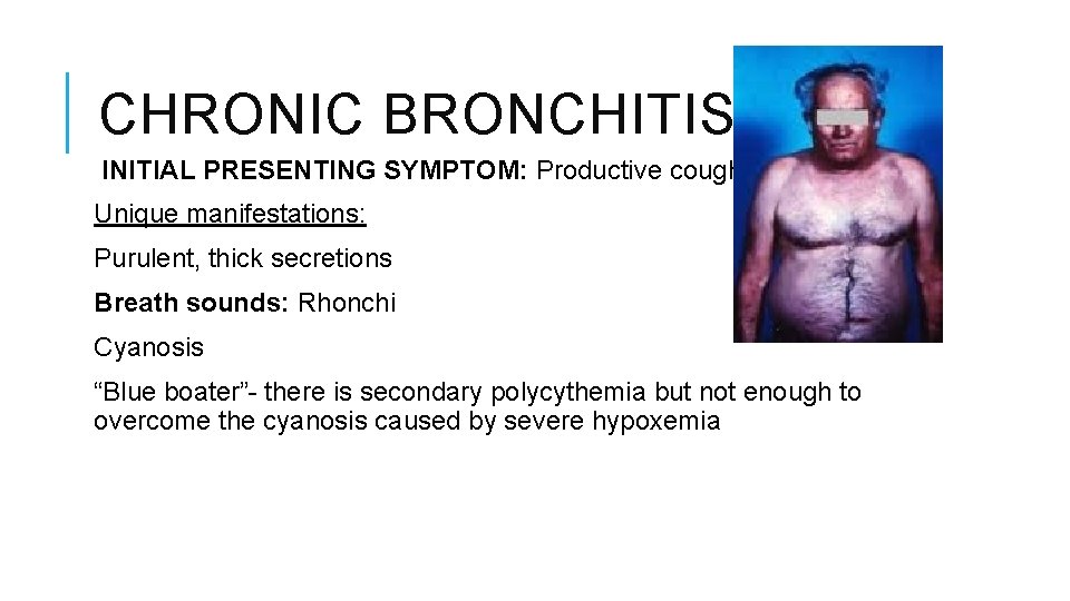 CHRONIC BRONCHITIS INITIAL PRESENTING SYMPTOM: Productive cough! Unique manifestations: Purulent, thick secretions Breath sounds: