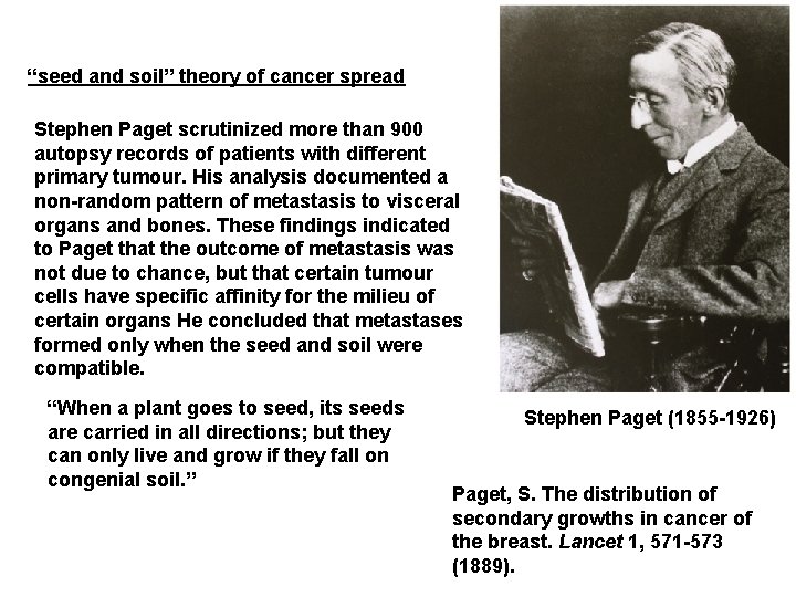 “seed and soil” theory of cancer spread Stephen Paget scrutinized more than 900 autopsy