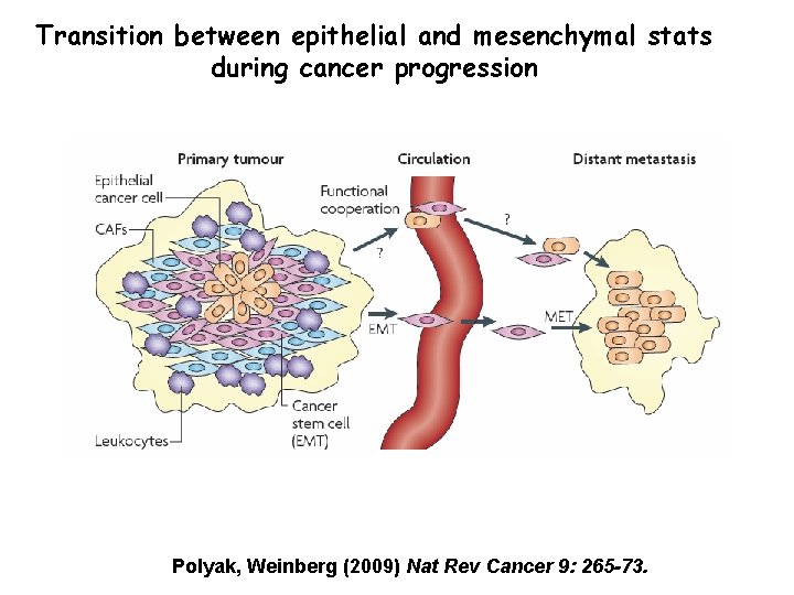 Transition between epithelial and mesenchymal stats during cancer progression Polyak, Weinberg (2009) Nat Rev