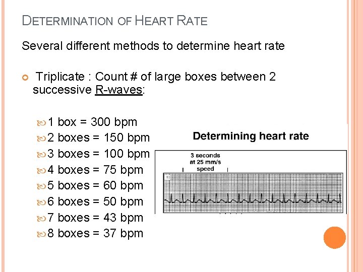 DETERMINATION OF HEART RATE Several different methods to determine heart rate Triplicate : Count