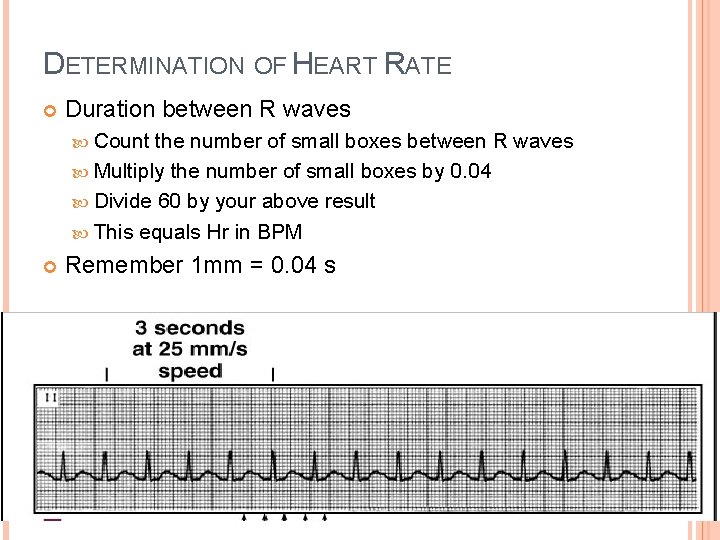 DETERMINATION OF HEART RATE Duration between R waves Count the number of small boxes