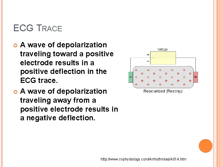 ECG TRACE A wave of depolarization traveling toward a positive electrode results in a