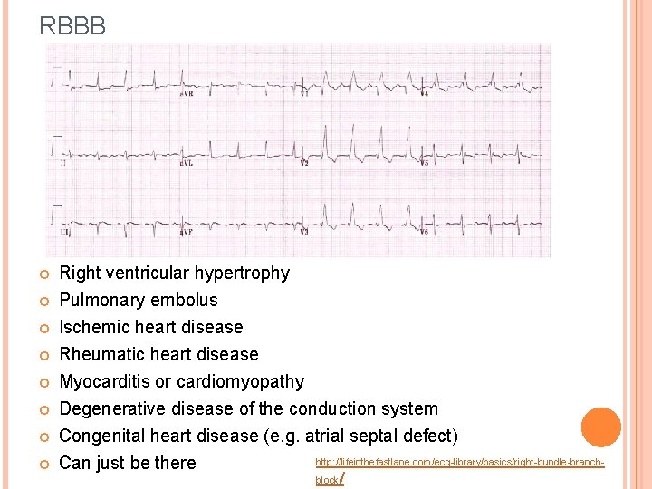 RBBB Right ventricular hypertrophy Pulmonary embolus Ischemic heart disease Rheumatic heart disease Myocarditis or