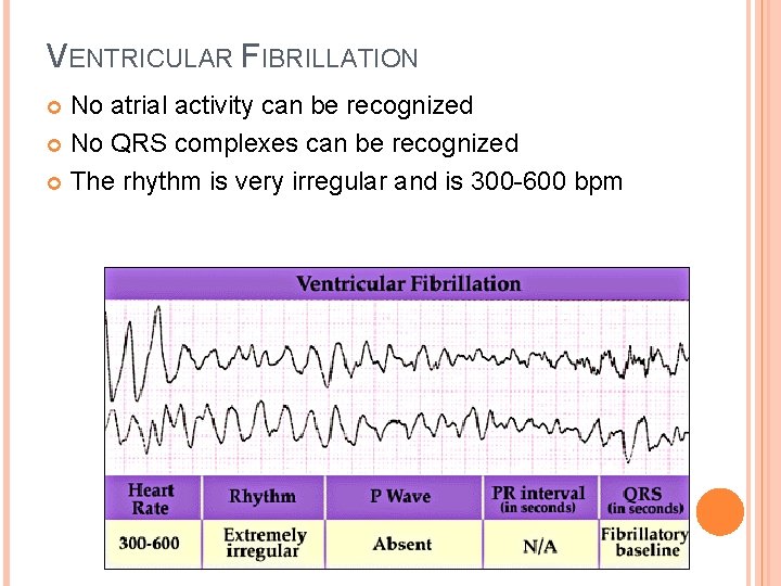 VENTRICULAR FIBRILLATION No atrial activity can be recognized No QRS complexes can be recognized