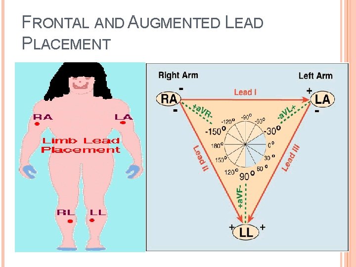 FRONTAL AND AUGMENTED LEAD PLACEMENT 