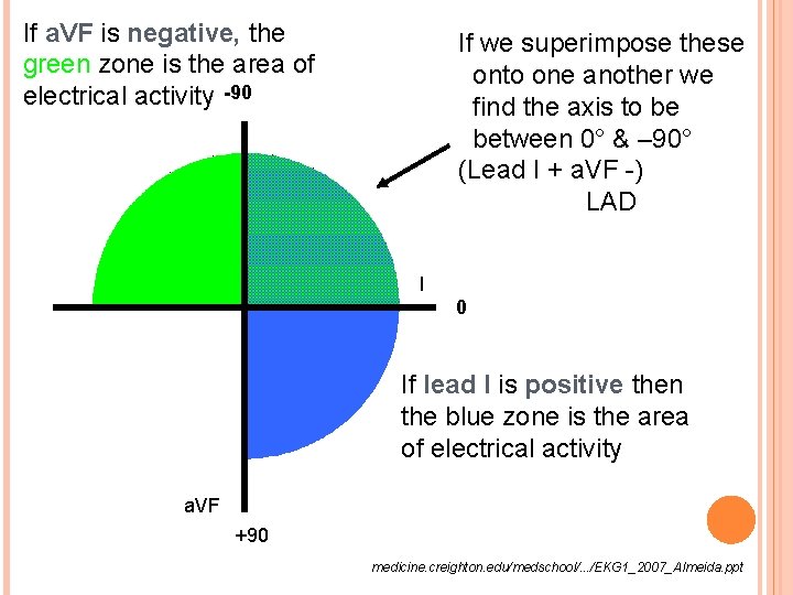 If a. VF is negative, the green zone is the area of electrical activity