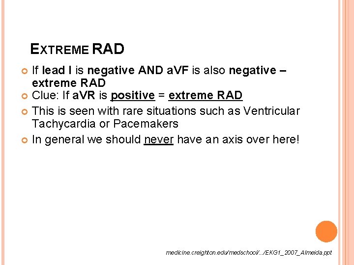 EXTREME RAD If lead I is negative AND a. VF is also negative –