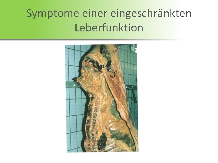 Symptome einer eingeschränkten Leberfunktion 