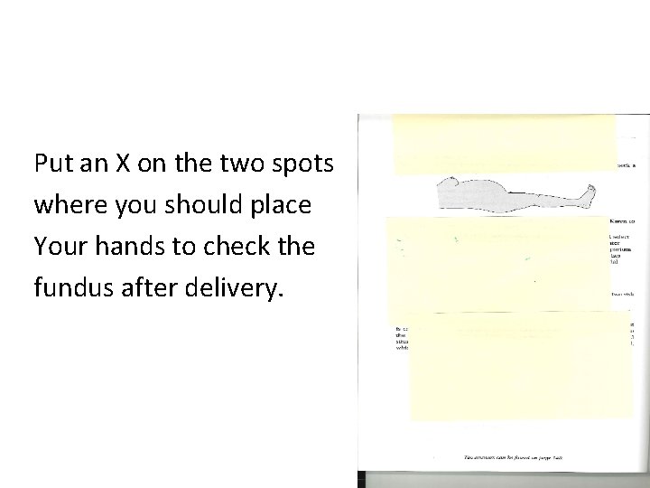 Put an X on the two spots where you should place Your hands to