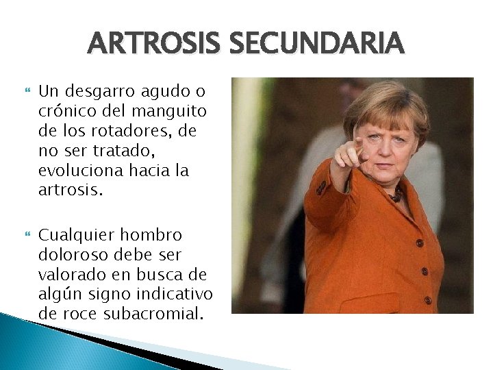 ARTROSIS SECUNDARIA Un desgarro agudo o crónico del manguito de los rotadores, de no