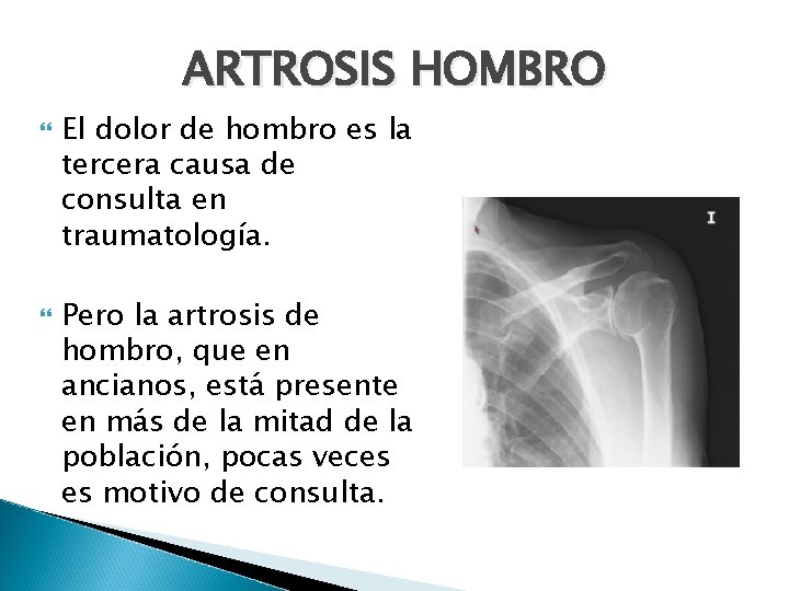 ARTROSIS HOMBRO El dolor de hombro es la tercera causa de consulta en traumatología.