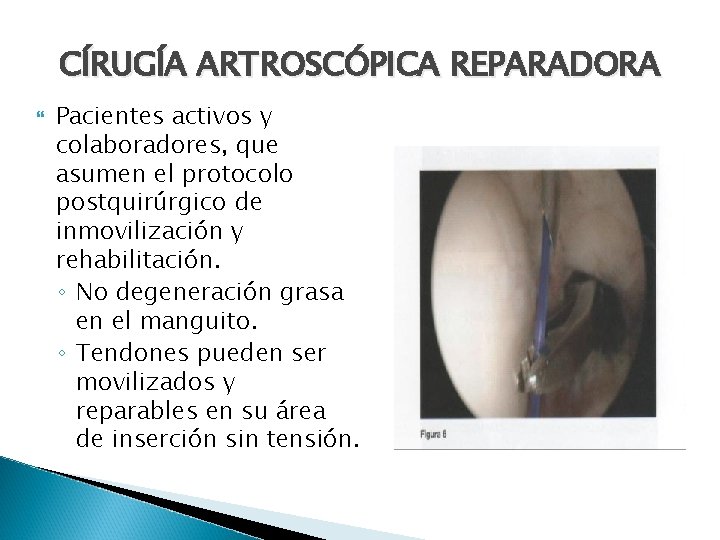 CÍRUGÍA ARTROSCÓPICA REPARADORA Pacientes activos y colaboradores, que asumen el protocolo postquirúrgico de inmovilización