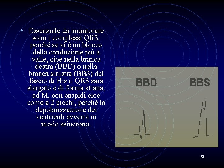  • Essenziale da monitorare sono i complessi QRS, perché se vi è un