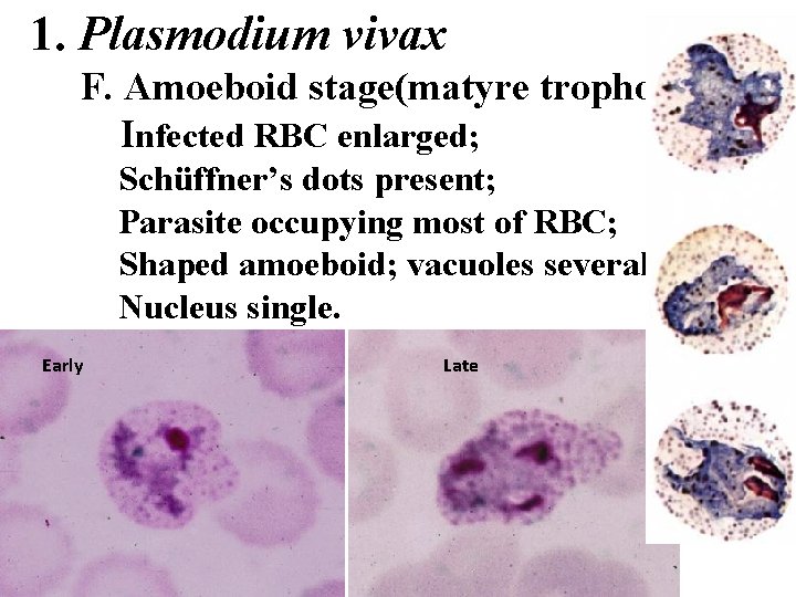 1. Plasmodium vivax F. Amoeboid stage(matyre trophozoite) Infected RBC enlarged; Schüffner’s dots present; Parasite