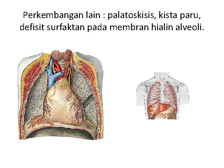 Perkembangan lain : palatoskisis, kista paru, defisit surfaktan pada membran hialin alveoli. 