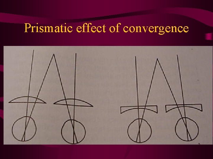 Prismatic effect of convergence 