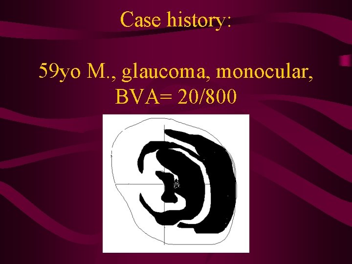 Case history: 59 yo M. , glaucoma, monocular, BVA= 20/800 