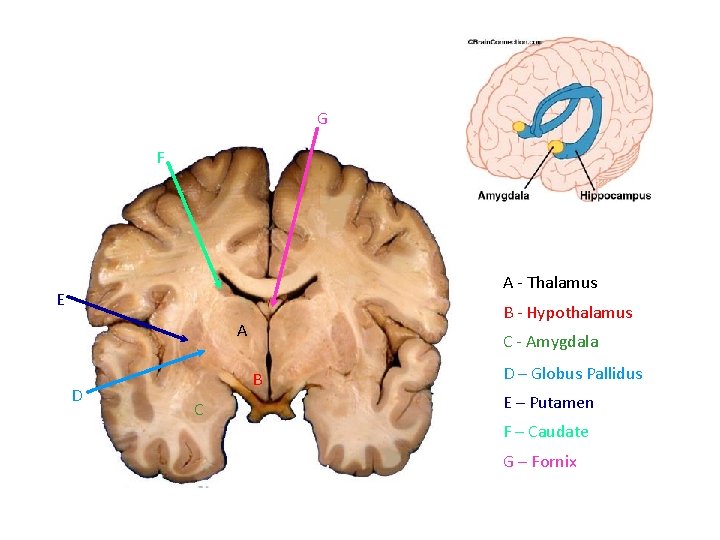 G F A - Thalamus E B - Hypothalamus A D C - Amygdala