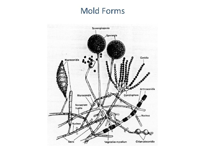 Mold Forms 