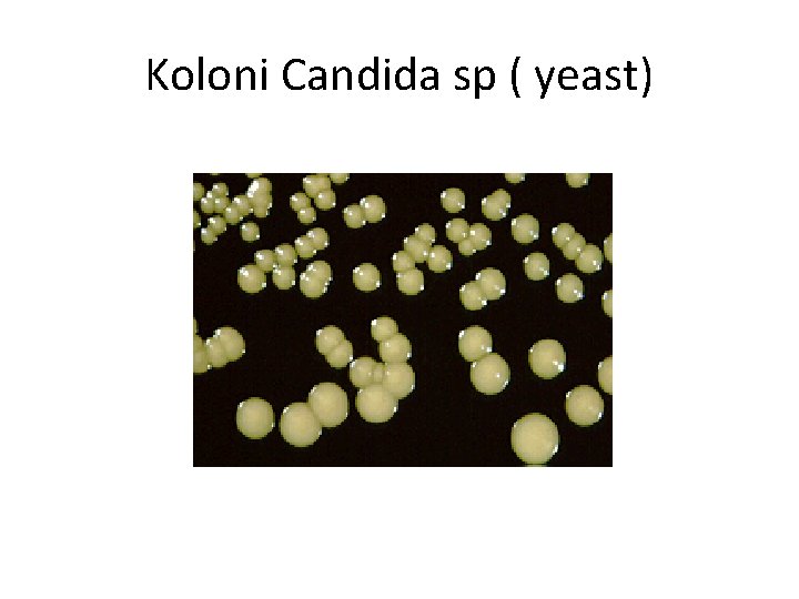 Koloni Candida sp ( yeast) 