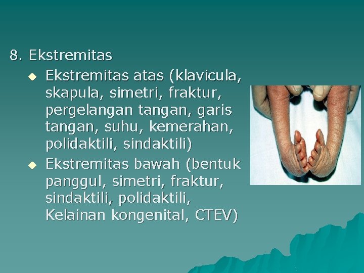 8. Ekstremitas u Ekstremitas atas (klavicula, skapula, simetri, fraktur, pergelangan tangan, garis tangan, suhu,