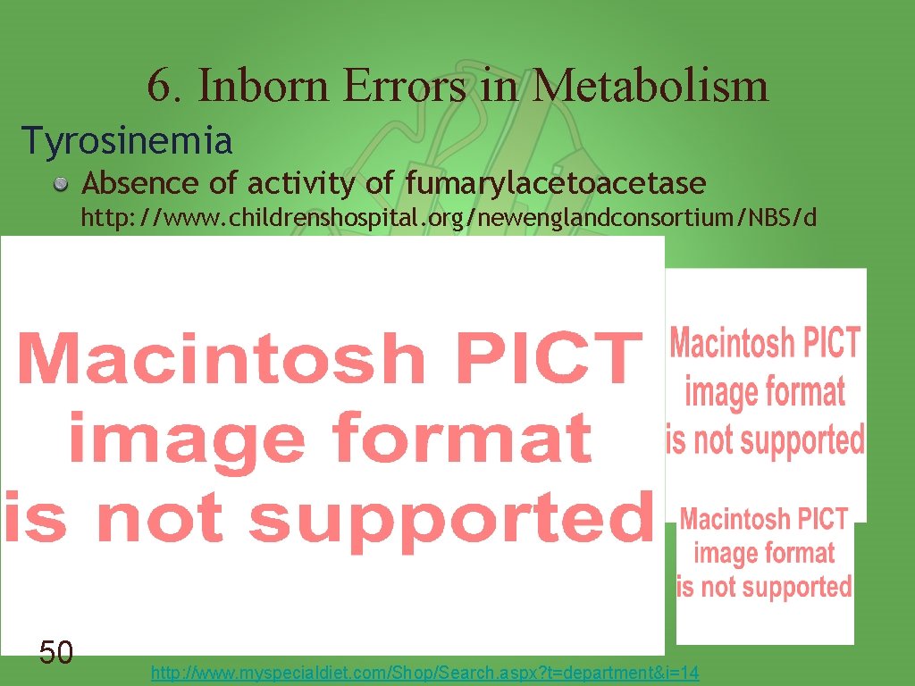 6. Inborn Errors in Metabolism Tyrosinemia Absence of activity of fumarylacetoacetase http: //www. childrenshospital.