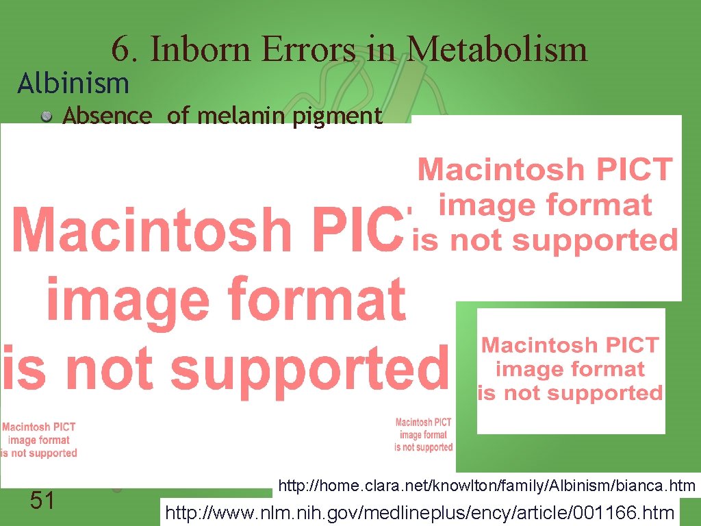 6. Inborn Errors in Metabolism Albinism Absence of melanin pigment 51 http: //home. clara.