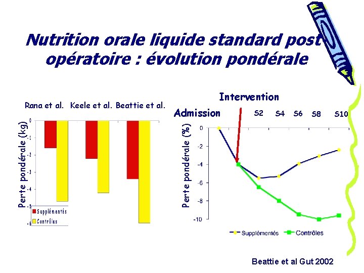 Nutrition orale liquide standard postopératoire : évolution pondérale Admission S 2 S 4 S
