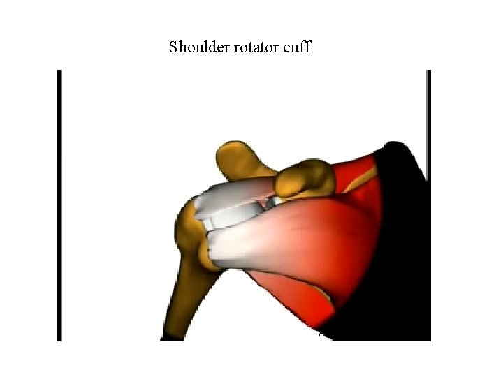 Shoulder rotator cuff 