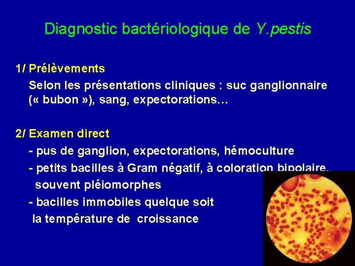 Diagnostic bactériologique de Y. pestis 1/ Prélèvements Selon les présentations cliniques : suc ganglionnaire