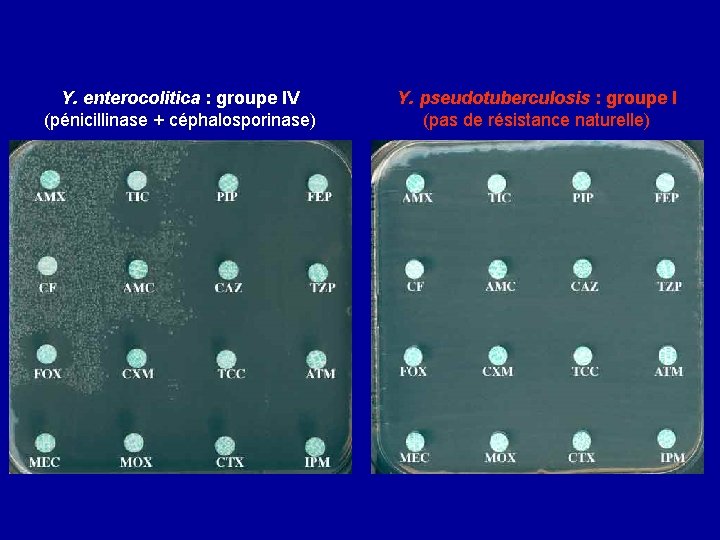Y. enterocolitica : groupe IV (pénicillinase + céphalosporinase) Y. pseudotuberculosis : groupe I (pas