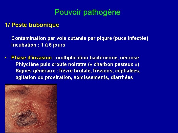 Pouvoir pathogène 1/ Peste bubonique Contamination par voie cutanée par piqure (puce infectée) Incubation