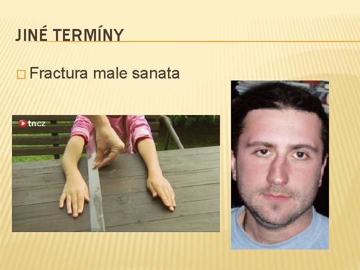 JINÉ TERMÍNY � Fractura male sanata 