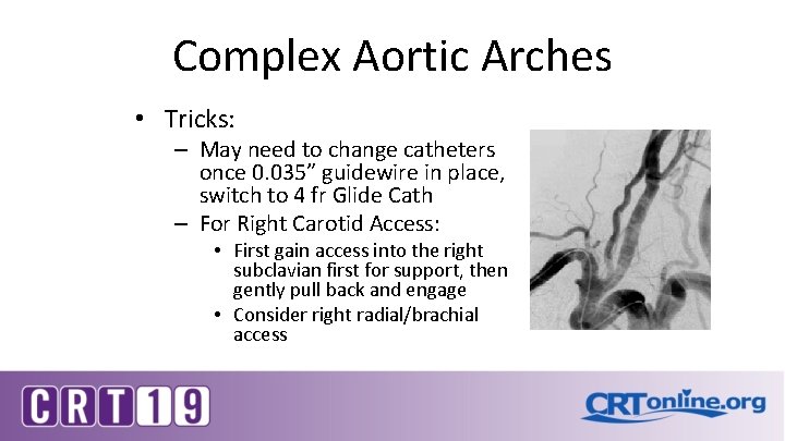 Complex Aortic Arches • Tricks: – May need to change catheters once 0. 035”