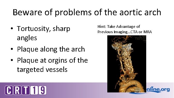 Beware of problems of the aortic arch • Tortuosity, sharp angles • Plaque along