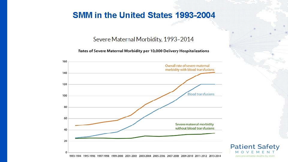 SMM in the United States 1993 -2004 