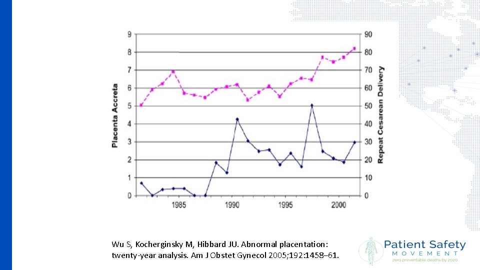 Wu S, Kocherginsky M, Hibbard JU. Abnormal placentation: twenty-year analysis. Am J Obstet Gynecol