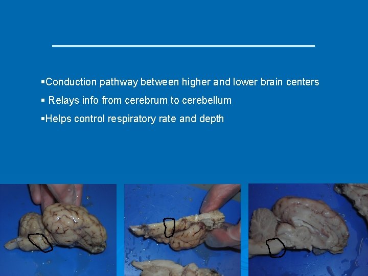 ___________ §Conduction pathway between higher and lower brain centers § Relays info from cerebrum