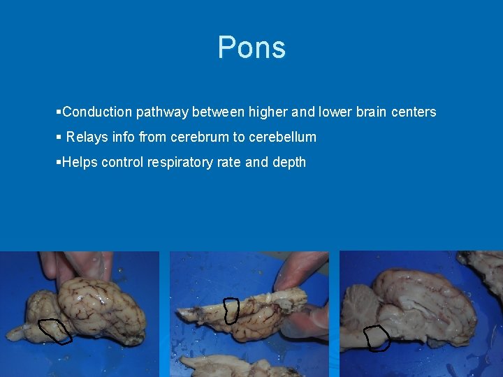 Pons §Conduction pathway between higher and lower brain centers § Relays info from cerebrum