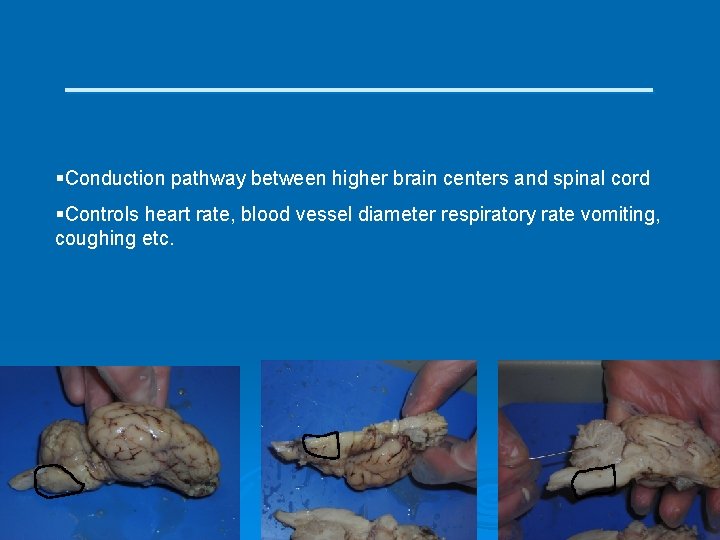 ____________ §Conduction pathway between higher brain centers and spinal cord §Controls heart rate, blood