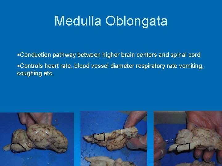 Medulla Oblongata §Conduction pathway between higher brain centers and spinal cord §Controls heart rate,