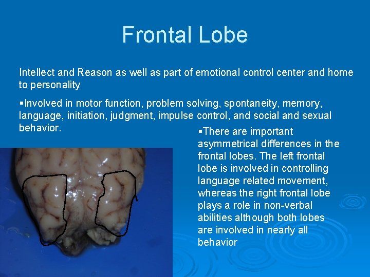 Frontal Lobe Intellect and Reason as well as part of emotional control center and