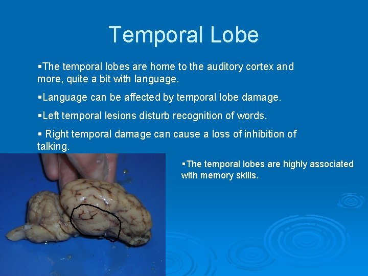 Temporal Lobe §The temporal lobes are home to the auditory cortex and more, quite