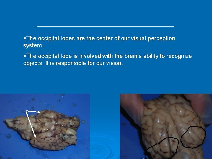 __________ §The occipital lobes are the center of our visual perception system. §The occipital