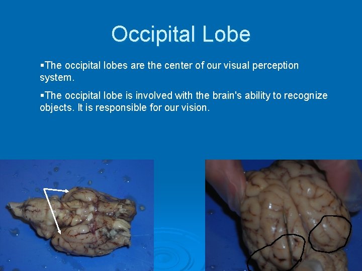 Occipital Lobe §The occipital lobes are the center of our visual perception system. §The