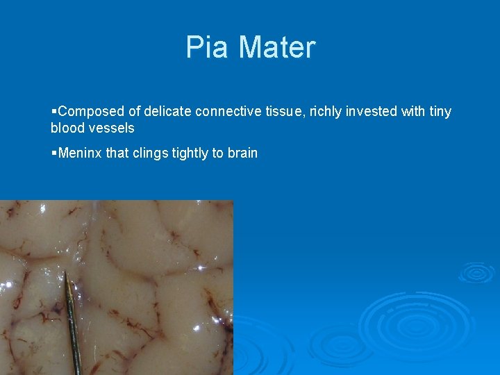 Pia Mater §Composed of delicate connective tissue, richly invested with tiny blood vessels §Meninx